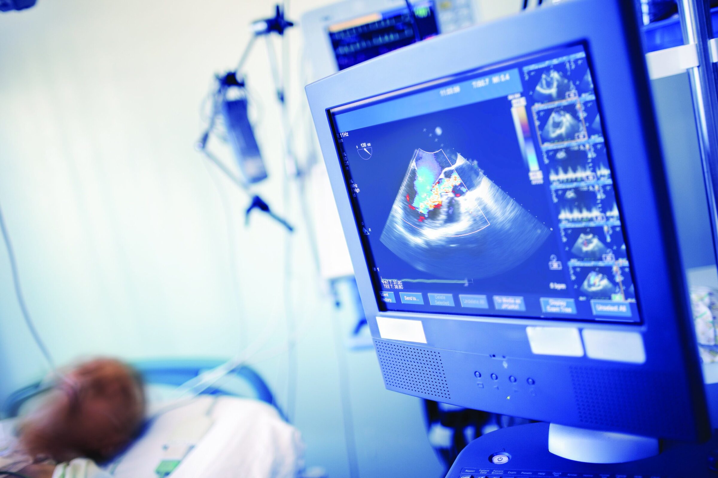 Cardiac ultrasound <em>Credit: iStock / sudok1</em>