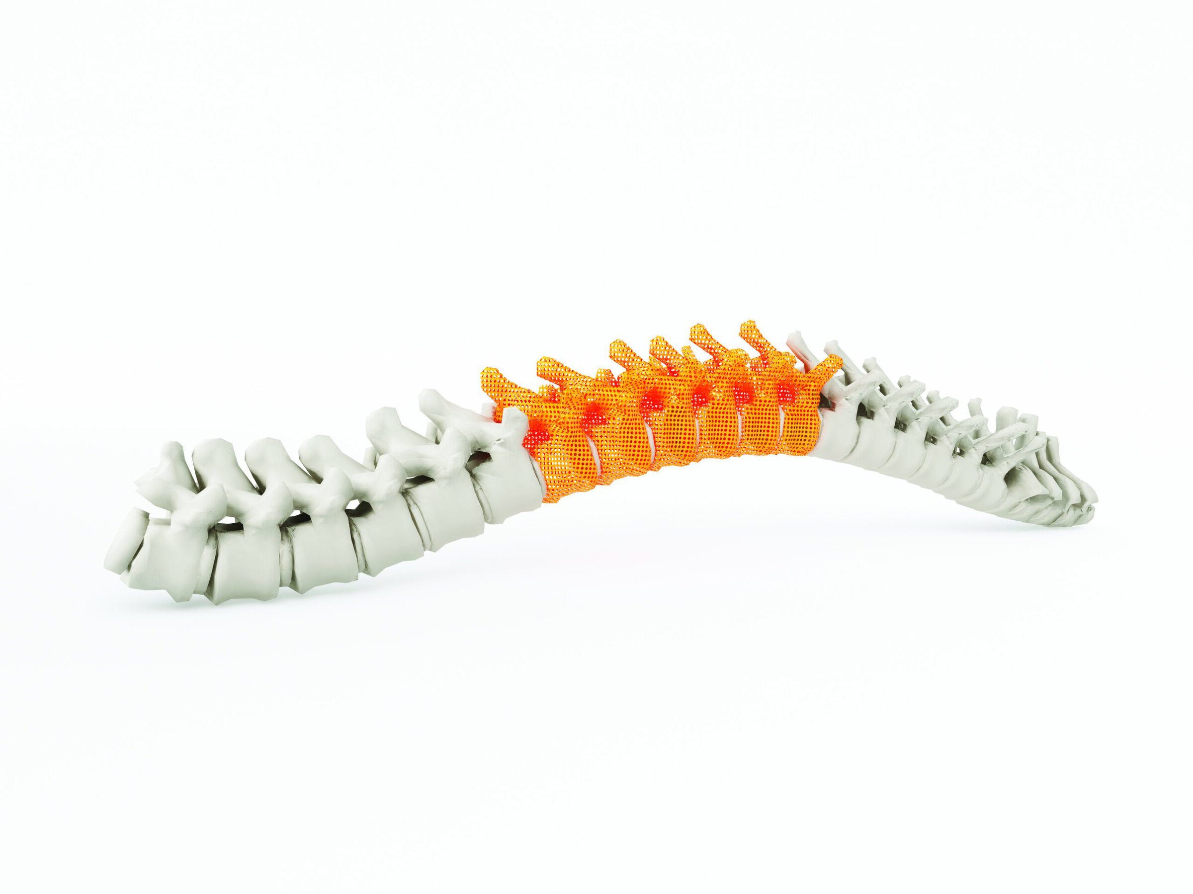 Spinal cord model with highlighted lumbar region, representing medical ceramics and biomaterials in spine health.