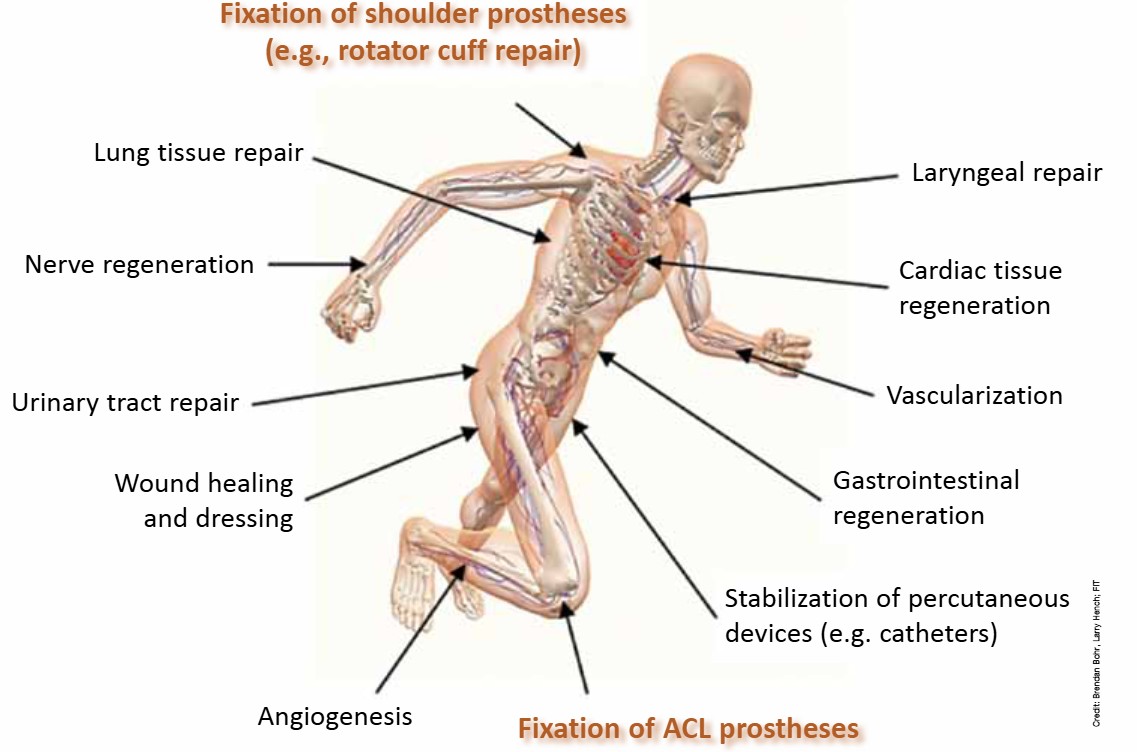 Bioactive glasses applications: shoulder/ACL prostheses fixation, tissue repair, nerve regeneration, angiogenesis, and more.
